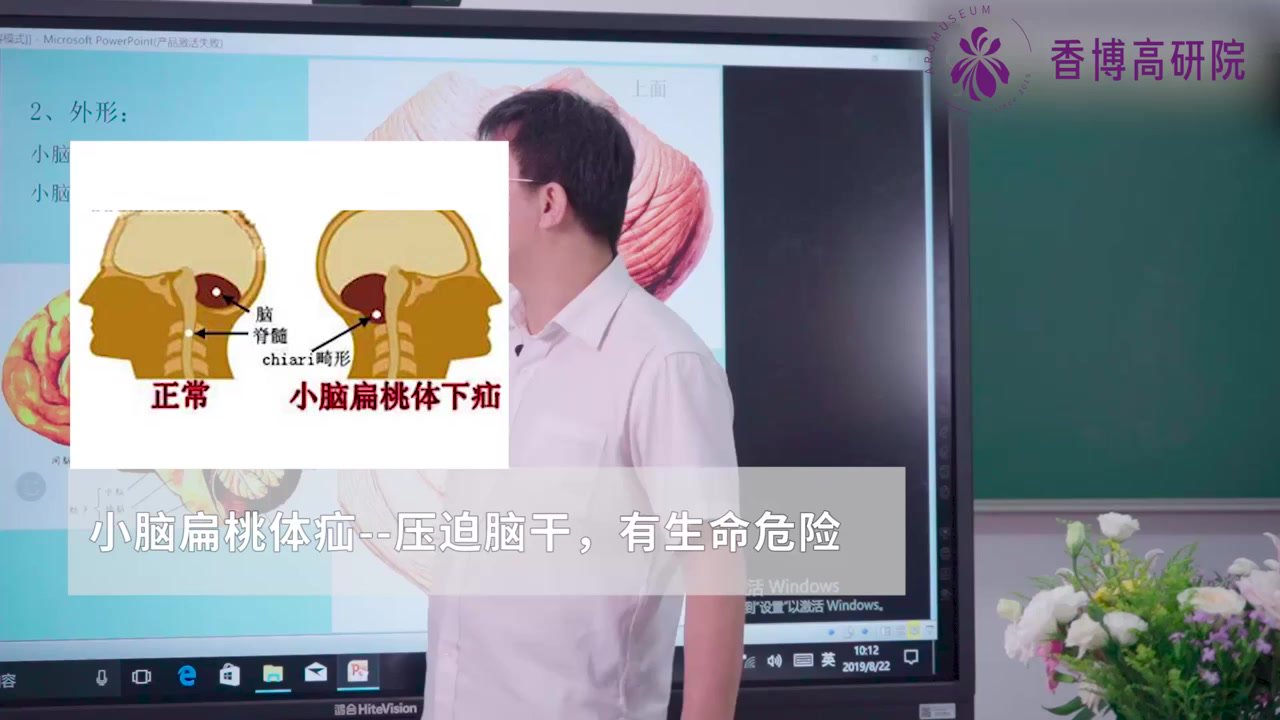 47.第四十七课.神经系统——脑部之概述、脑干、小脑、间脑.mp4